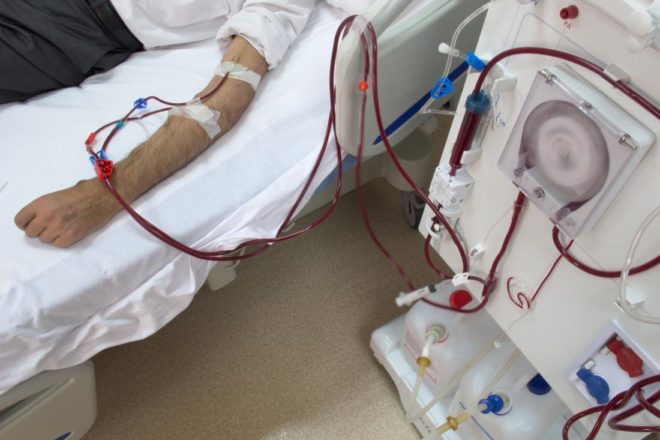 Böbrek yetmezliği nedenleri